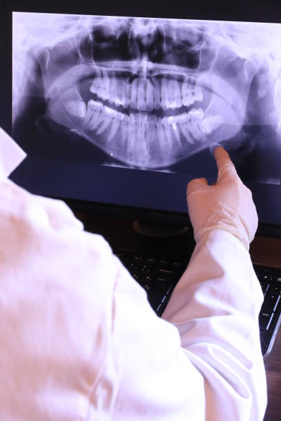 Best Emergency Dental Extractions in Hood River, OR