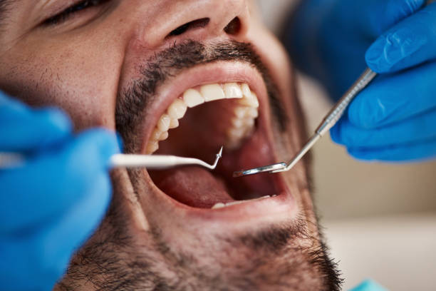 Best Emergency Cosmetic Dentistry in Hood River, OR